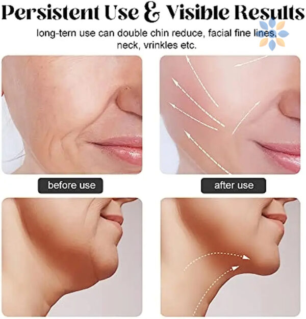 Colágeno Hidrolizado con Masajeador Facial para Papada